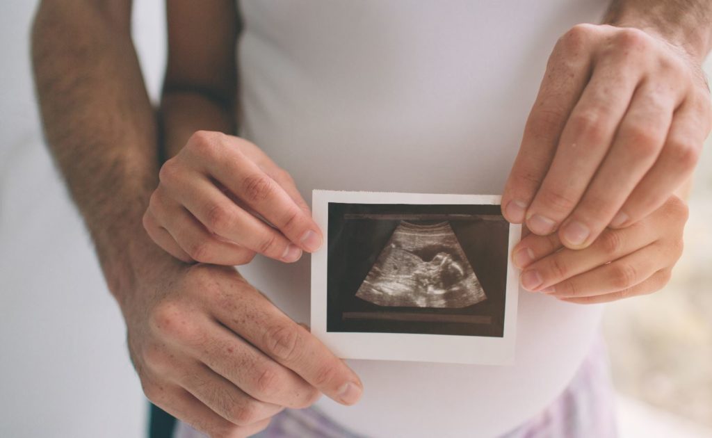 Frau und Mann halten Ultraschallbild auf Babybauch
