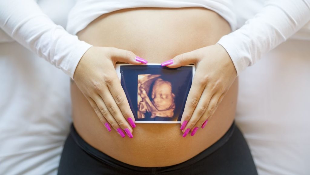 Frau hält Ultraschallbild auf Babybauch