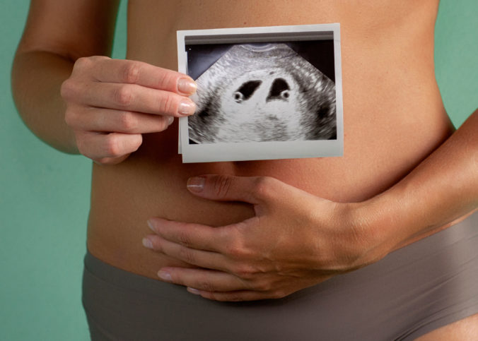 Ultraschallbild Zwillinge mit Babybauch