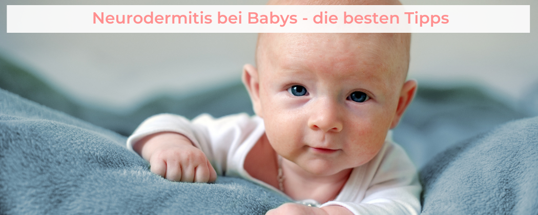 Banner: Neurodermitis bei Babys – die besten Tipps