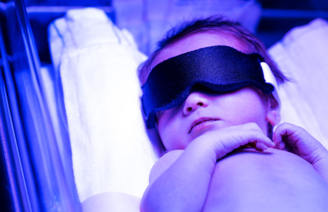 Neugeborenes wird mit Phototherapie behandelt