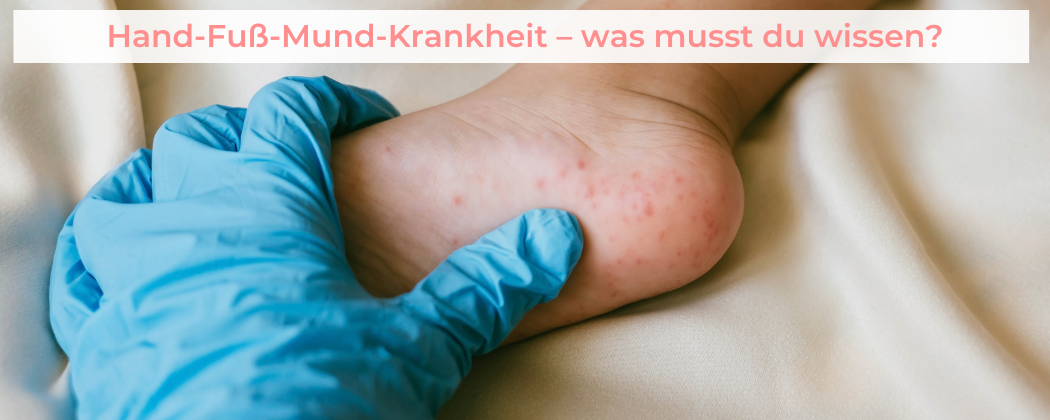 Banner: Hand-Fuß-Mund – Was musst du wissen und beachten?